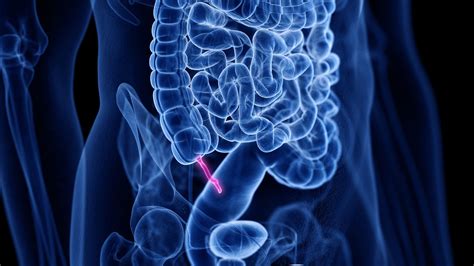 Appendix