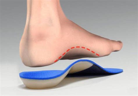 Arch Support High: A Comprehensive Guide to Enhanced Foot Health and Posture