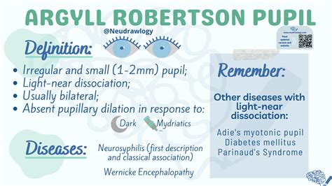 Argyll Robertson Pupil: A Guide to Understanding This Unique Neurological Phenomenon