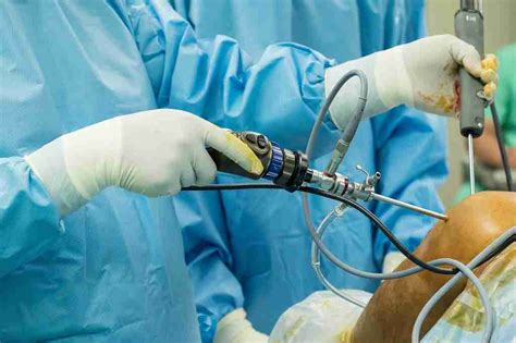 Arthroscopic surgery: