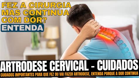 Artrodese Cervical: Restaurando a Mobilidade e Aliviando a Dor