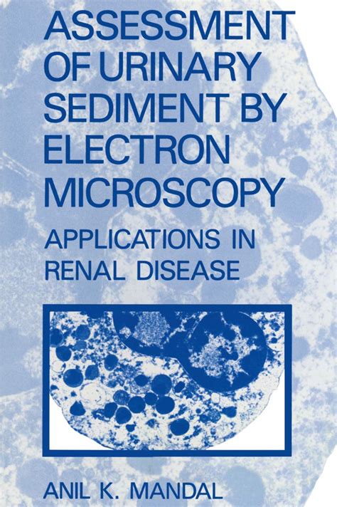 Assessment of Urinary Sediment by Electron Microscopy Applications in Renal Disease Kindle Editon
