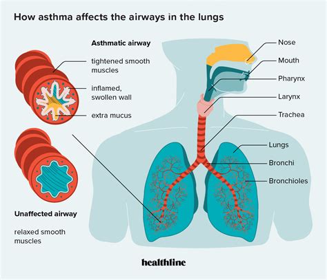 Asthma affects up to 1 in 200 cats