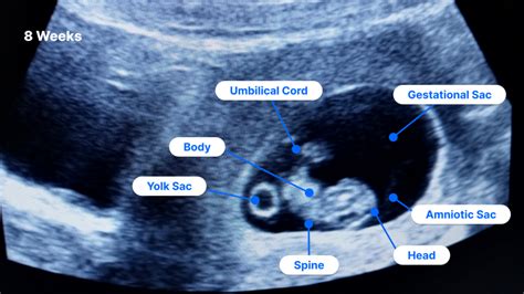 At 8 weeks and 5 days pregnant, you're nearing the end of your first trimester.