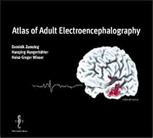 Atlas of Adult Electroencephalography Epub