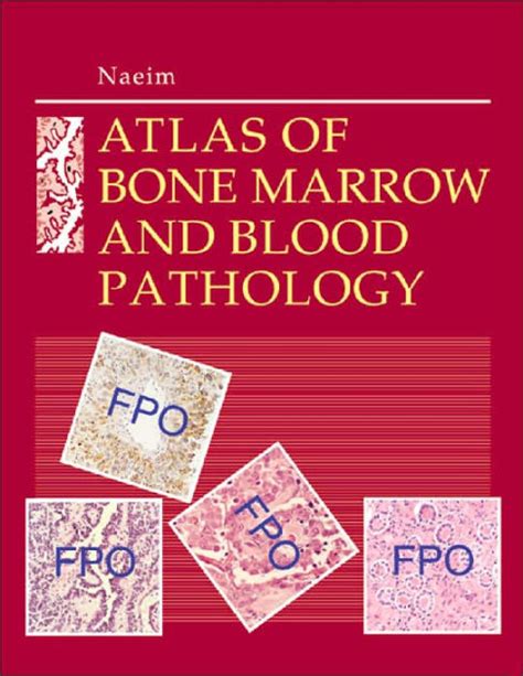 Atlas of Bone Marrow and Blood Pathology A Volume in the Atlases in Diagnostic Surgical Pathology S Doc