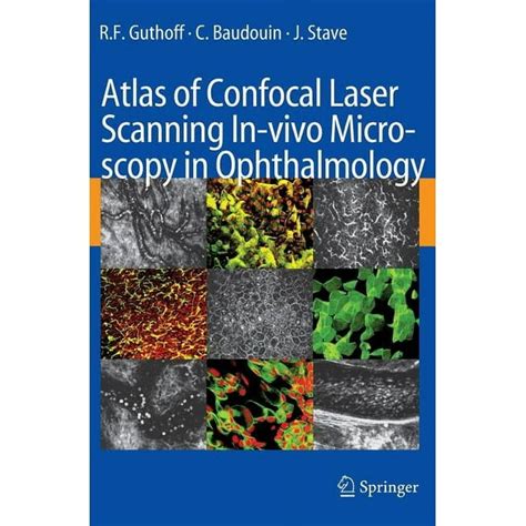 Atlas of Confocal Laser Scanning In-vivo Microscopy in Ophthalmology 1st Edition Doc