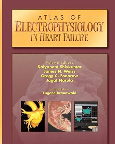 Atlas of Electrophysiology in Heart Failure 1st Edition Epub