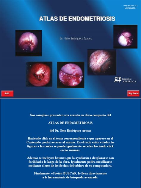 Atlas of Endometriosis PDF