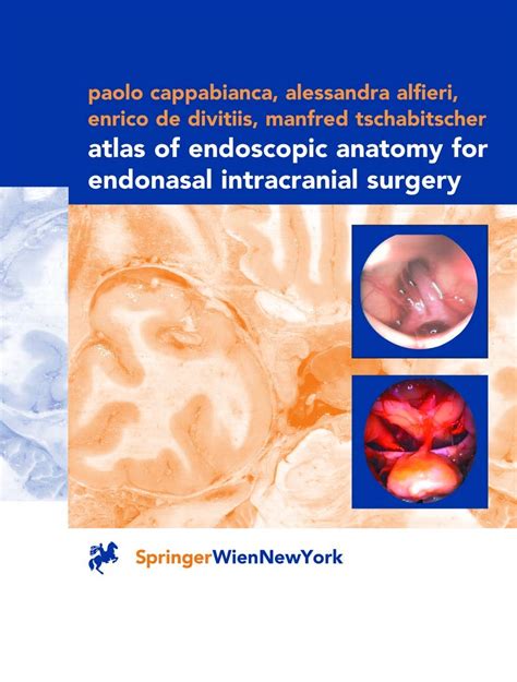 Atlas of Endoscopic Anatomy for Endonasal Intracranial Surgery 1st Edition PDF