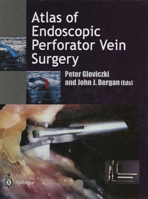 Atlas of Endoscopic Perforator Vein Surgery Reader
