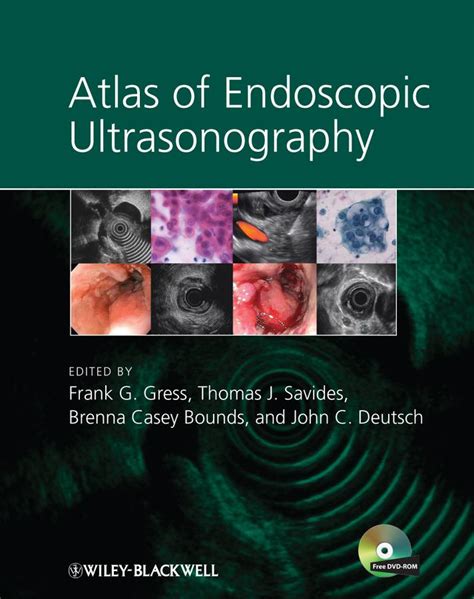 Atlas of Endoscopic Ultrasound Reader
