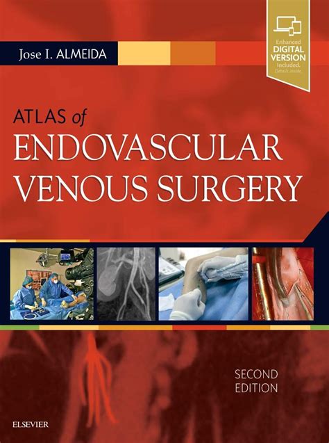 Atlas of Endovascular Venous Surgery Expert Consult - Online and Print Epub