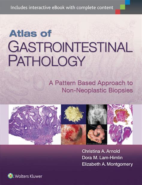 Atlas of Gastrointestinal Pathology Kindle Editon