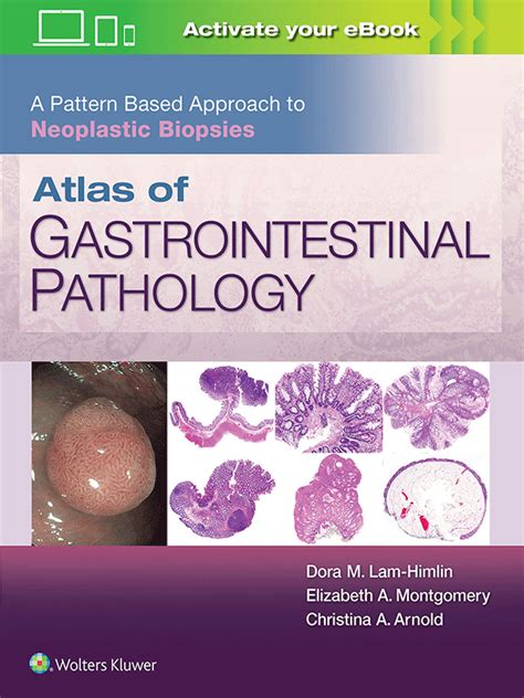 Atlas of Gastrointestinal Pathology Kindle Editon