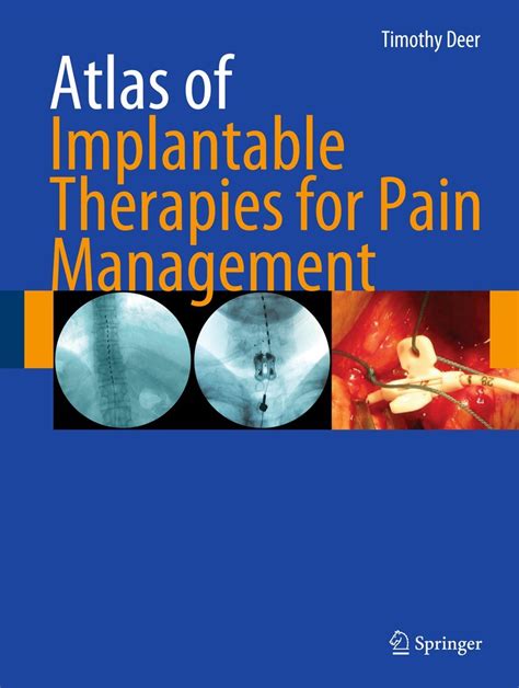 Atlas of Implantable Therapies for Pain Management PDF