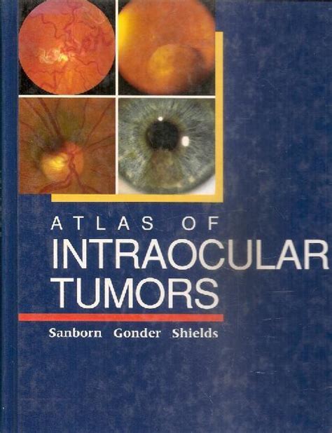 Atlas of Intraocular Tumors Kindle Editon