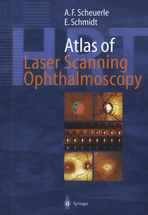 Atlas of Laser Scanning Ophthalmoscopy Reader