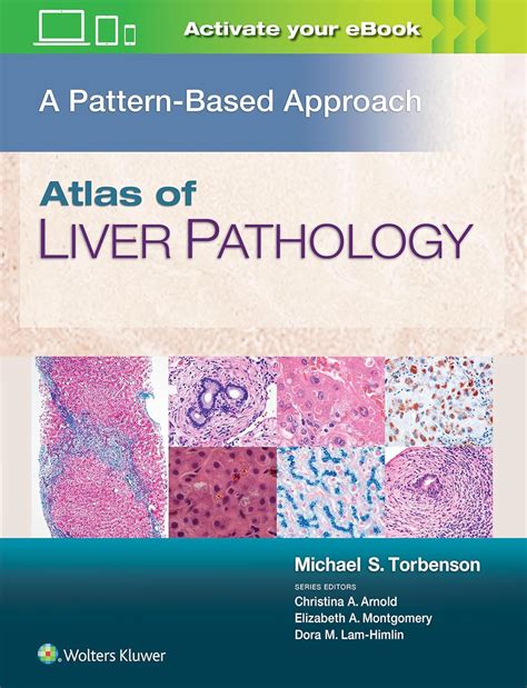 Atlas of Liver Epub