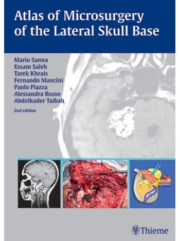 Atlas of Microsurgery of the Lateral Skull Base 2nd Edition Doc