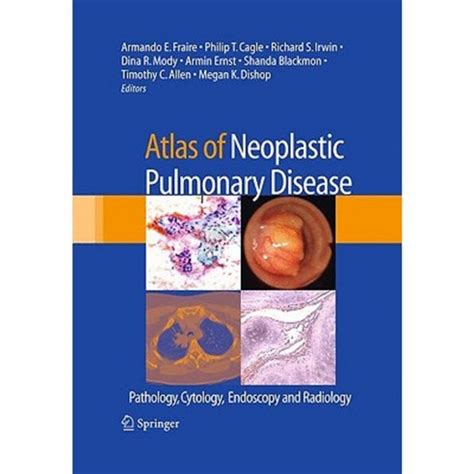Atlas of Neoplastic Pulmonary Disease Pathology, Cytology, Endoscopy and Radiology Doc