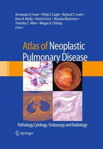 Atlas of Neoplastic Pulmonary Disease Pathology, Cytology, Endoscopy and Radiology Doc