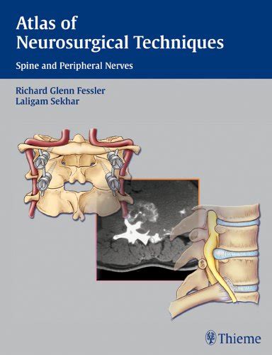 Atlas of Neurosurgical Techniques Spine and Peripheral Nerves Epub