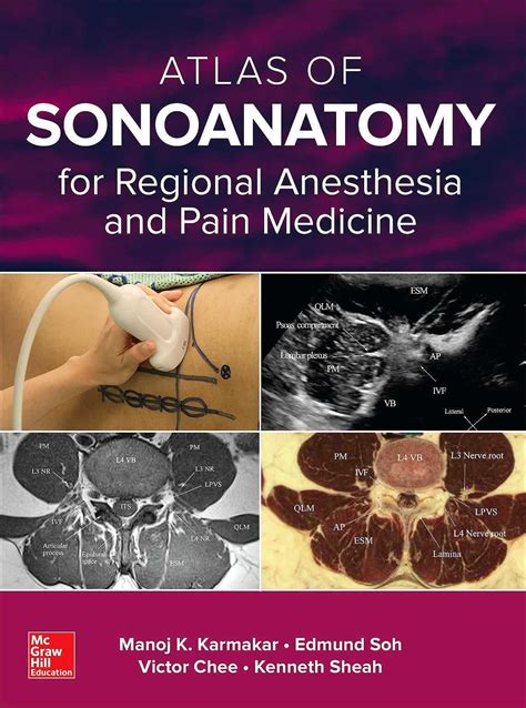 Atlas of Sonoanatomy for Regional Anesthesia and Pain Medicine Kindle Editon