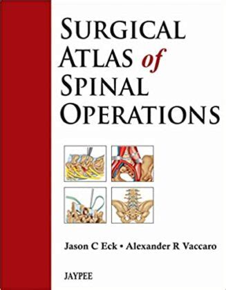 Atlas of Spinal Operations 1st Edition Epub