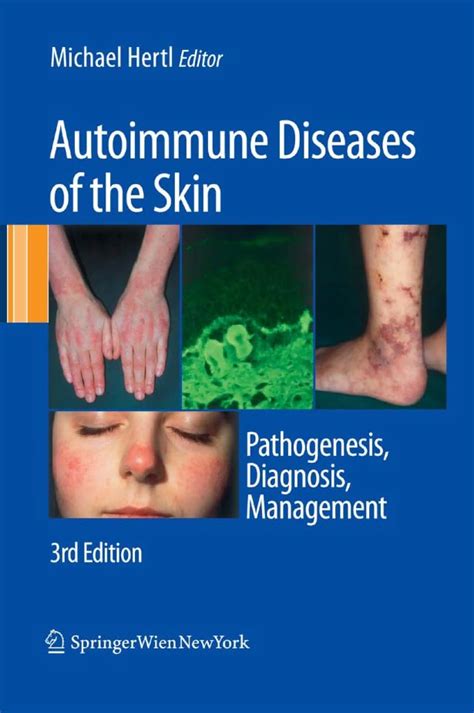 Autoimmune Diseases of the Skin Pathogenesis Epub