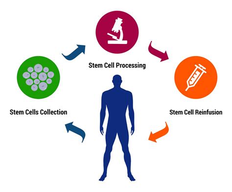 Autologous Stem Cell Therapy: