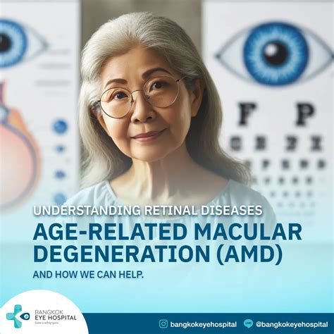 Avaangeleyes: A Comprehensive Guide to Age-Related Macular Degeneration (AMD)