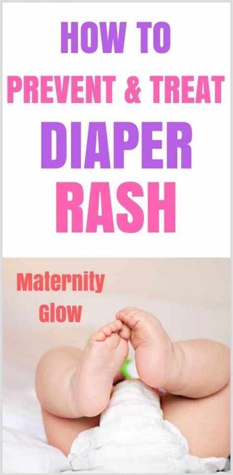 Baby Red Bottoms: A Comprehensive Guide to Treating, Preventing, and Recognizing Diaper Rash