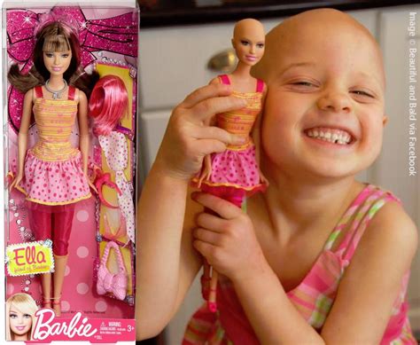 Bald Barbie Dolls: 7 Ways to Celebrate Diversity & Inclusion