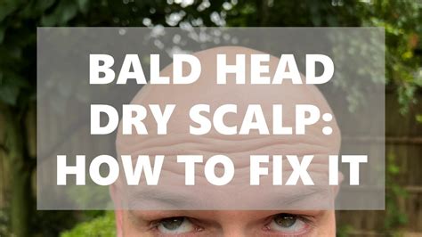 Bald Head Patches: A Guide to Prevention, Treatment, and Solutions