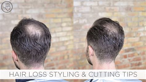 Balding Crown Styling: 50+ Cutting-Edge Solutions for Thinning Hair