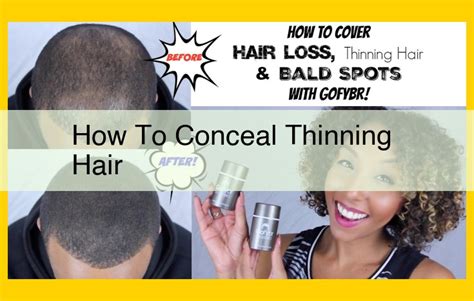 Balding Crown Styling: A Comprehensive Guide to Concealing and Enhancing Thinning Hair