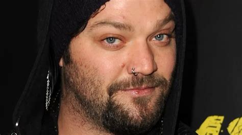 Bam Margera's Teeth: A Saga of Neglect