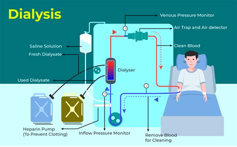 Basic Clinical Dialysis PDF