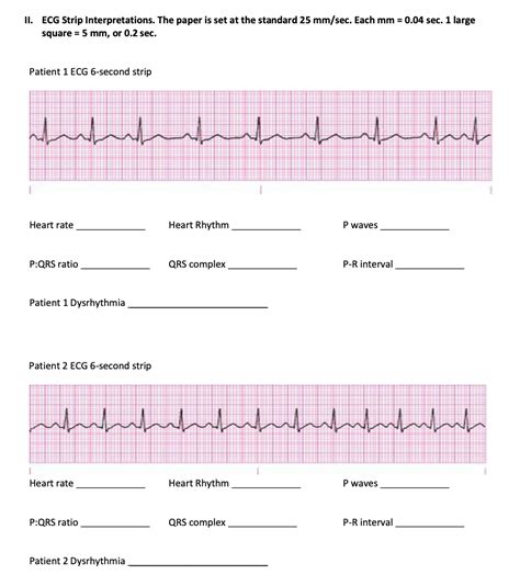 Basic Ecg Interpretation Practice Test Answers Kindle Editon