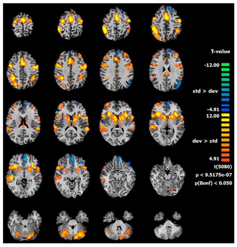 Beauty and the Brain - A Psychophysiological and Inernational Perspective Epub