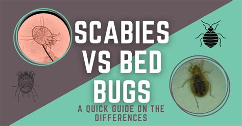 Bed Bugs on Body VS: 14 Unmistakable Signs You Should Know in 2025