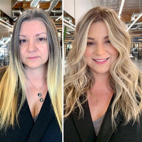 Before and After: 10,000+ Transformations for Thin Hair on Top