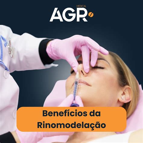 Benefícios da Rinomodelação