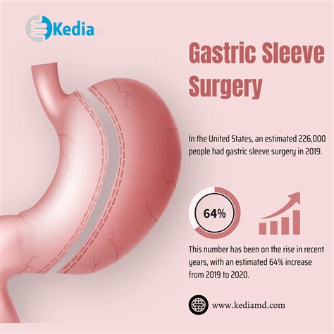 Benefits of Gastric Sleeve Surgery