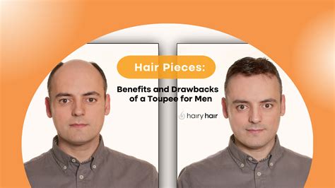 Benefits of Toupees for Men