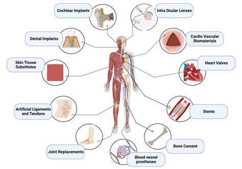 Biomedical Implants: