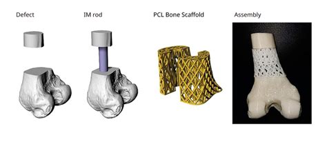 Bioresorbable Scaffolds for Bone and Cartilage Repair