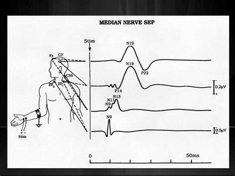 Biotechnology in Japan - a Comprehensive Guide Topographic Mapping of EEG and Evoked Potentials PDF