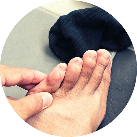 Blister Prevention: The Ultimate Guide to Keeping Your Feet Cool and Comfortable